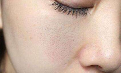 【鼻子最容易挤出这些白色的“条状物”，它到底是什么？】