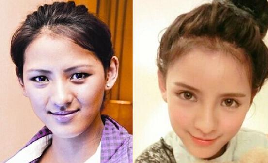 整容怎么整才能整得又自然又美,长脸整容怎样整好看