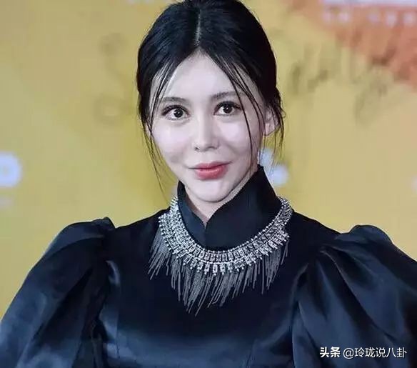 有哪些明星过度整容惨不忍睹,整容失败女明星今昔对比