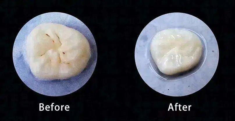 儿童牙齿坏了需要补吗六岁了,儿童牙齿蛀掉了治疗会疼吗