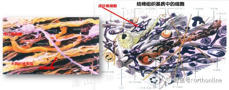 手部肌腱不完全断裂能完全复原吗,手部屈指肌腱损伤最难处理的部位