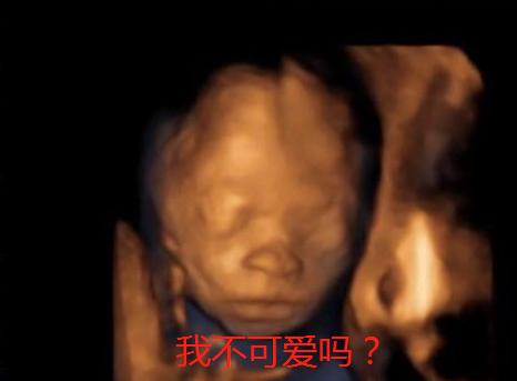 澶╂墠鑳庡効瀹岀粨,澶╂墠鑳庡効