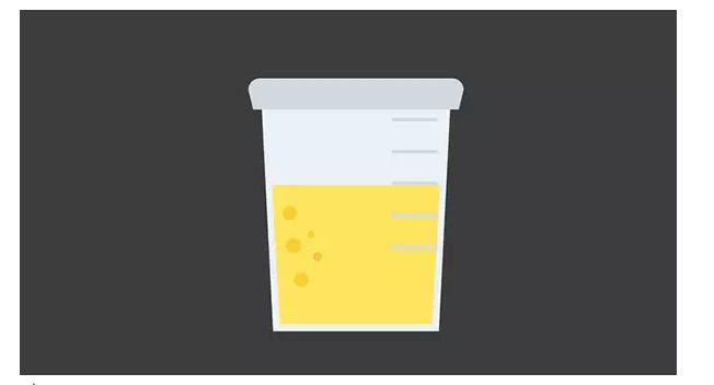 一分钟告诉你体检的注意事项,体检要知道的事