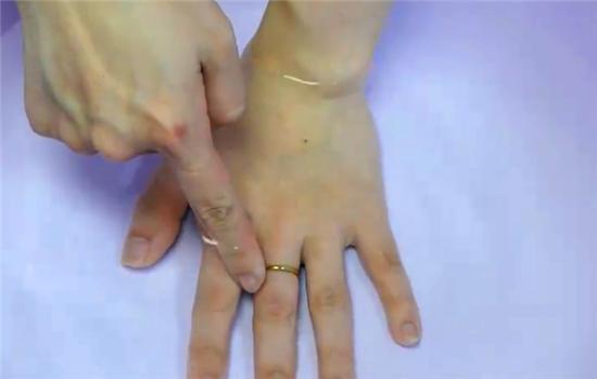 戒指戴久了取不出来今天教你一招,用牙签不用绳子就能把戒指弄出来