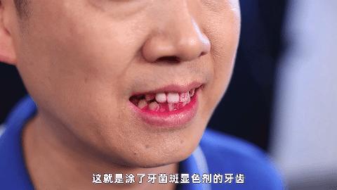 2021好用电动牙刷排行榜,2020最推荐的电动牙刷是哪一款