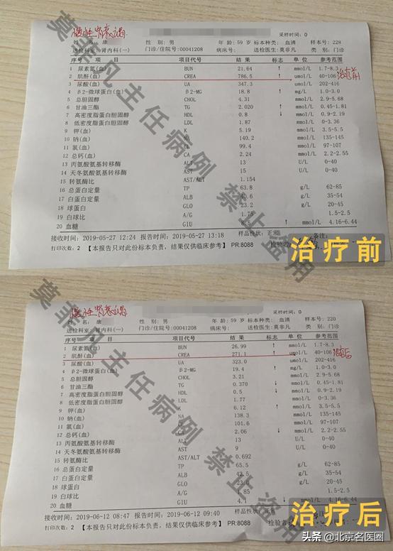 肾衰竭尿毒症中医治疗可靠吗？59岁的他用17天回答了这个问题
