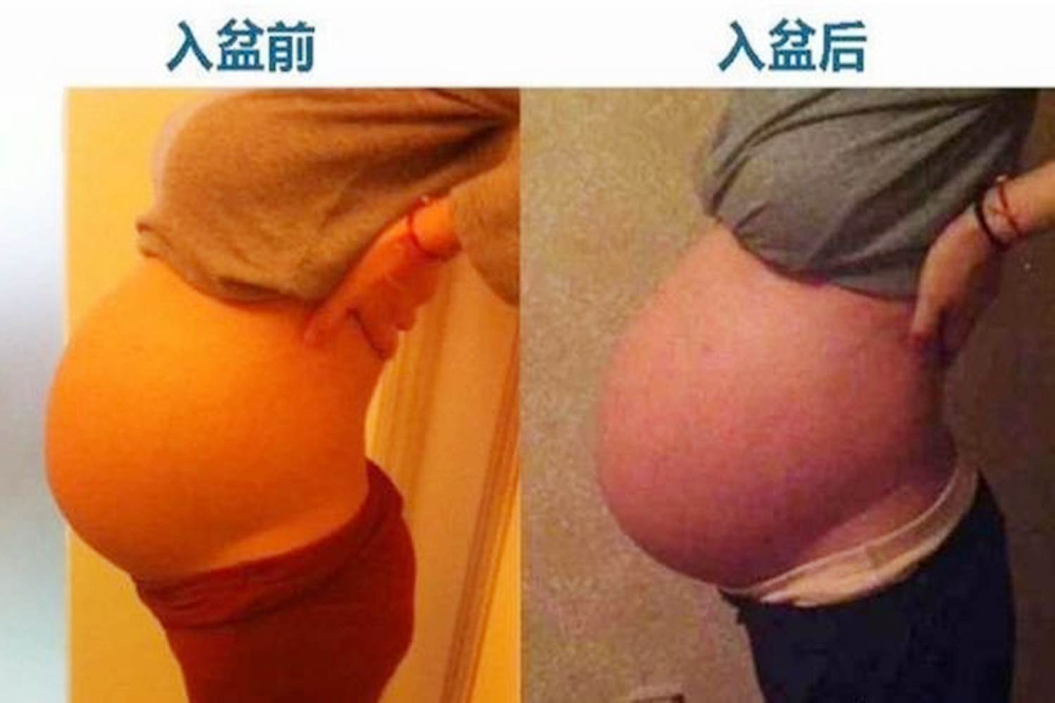 孕中期的肚子像入盆了一样,孕妇肚子往下走是胎儿入盆了吗