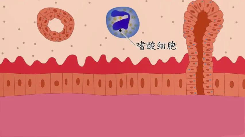 鼻炎长期鼻塞吃什么药,老鼻炎患者怎么治疗