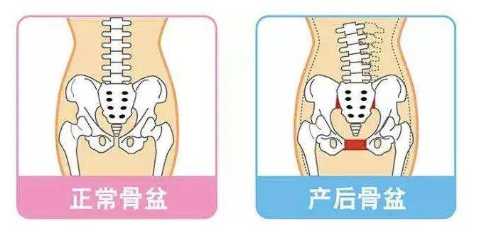 产后妈妈肢体疼痛问题,产后妈妈全身骨头疼