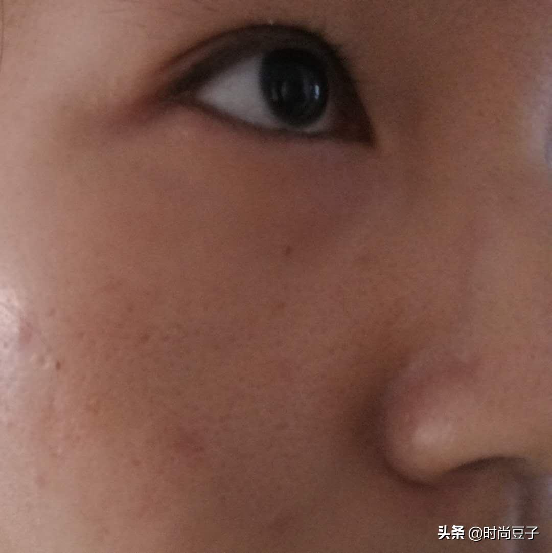 油痘肌推荐保湿定妆喷雾,油痘肌修复喷雾推荐测评