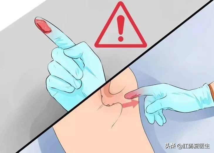 医院里让人尴尬的几项检查,医院里哪些让人尴尬的检查