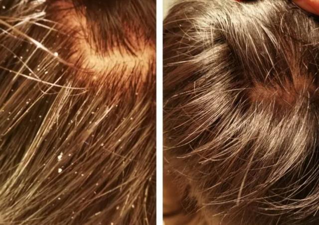 洗发露油性头发推荐,油头用了滋润洗发水