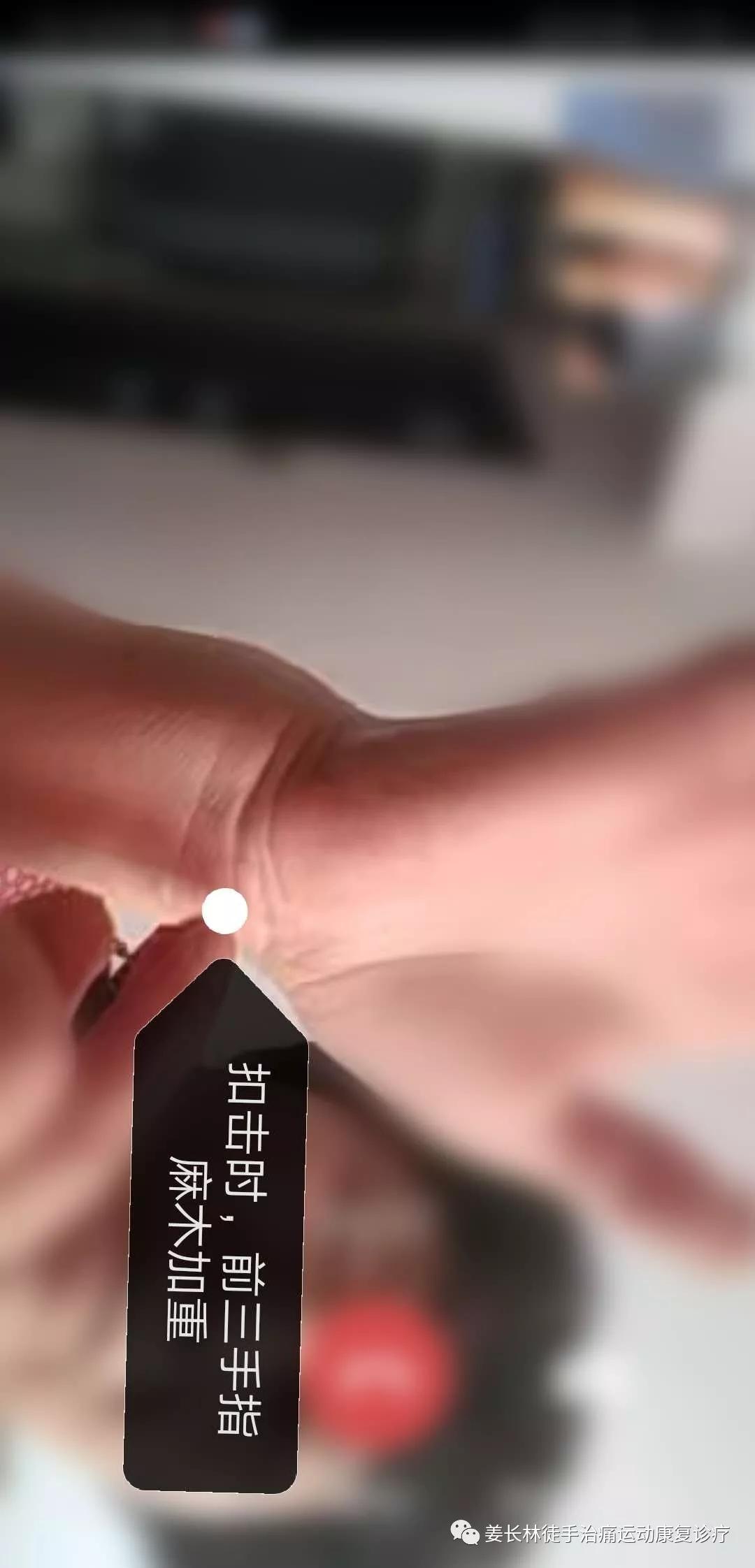 日常生活中的疼痛1—手麻(长时间玩手机)的判断和自我纠正