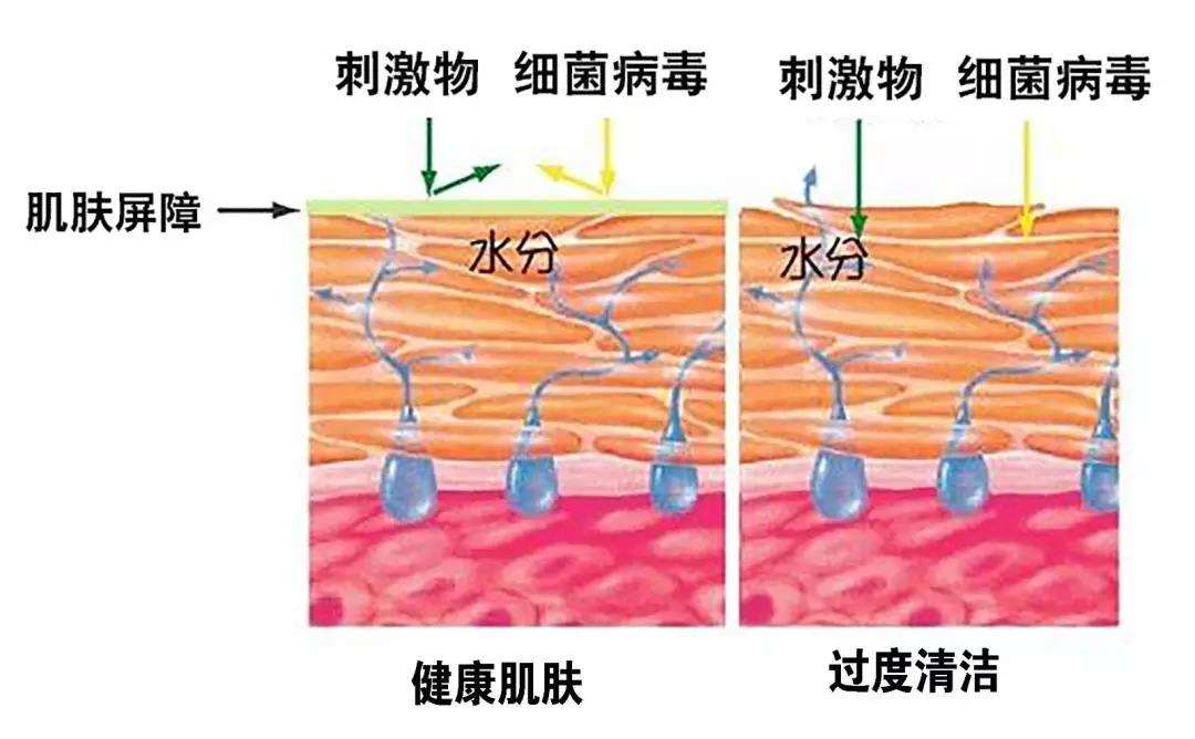 远离这6款会烂脸的洗面奶,洗面奶黑名单第1款千万别用