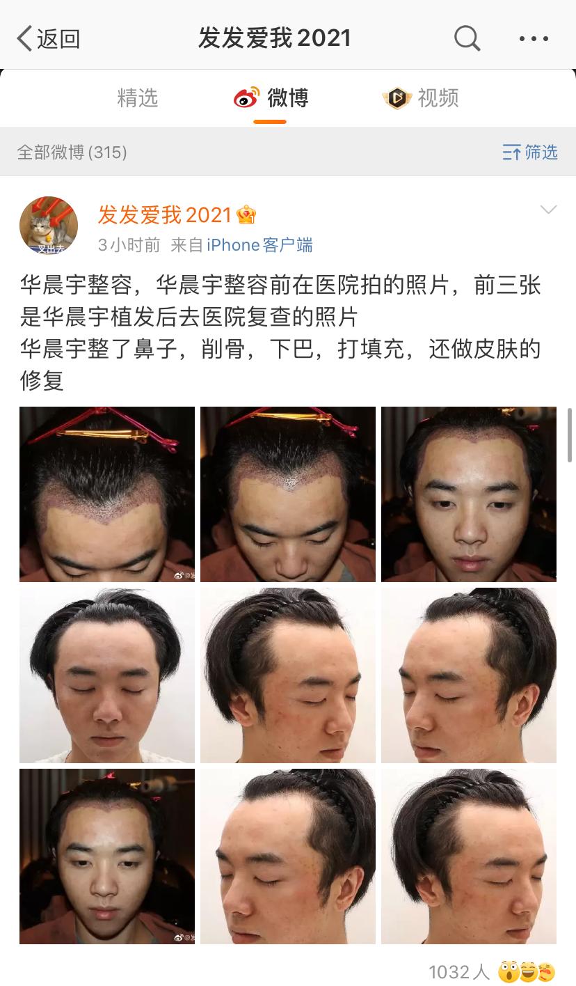 网友：张碧晨插足成小三？华晨宇“实锤”整容“？律师起诉？