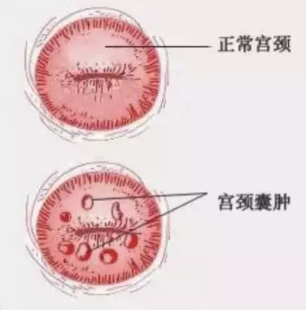 好文收藏|得了妇科病，还能买保险吗？