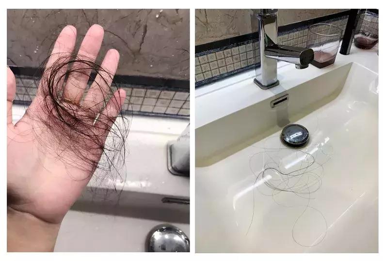 挑战3天不洗头依然干爽不油腻,4天不洗头头发就油了正常吗