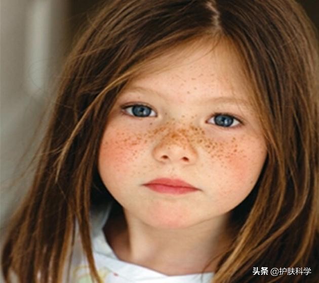 脸上长斑怎么办快速解决方法,脸上长黑斑怎样才能最快消除斑