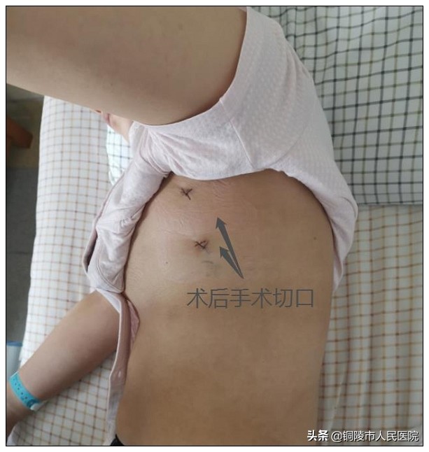 手心出汗是虚吗,手心出汗却不冰凉是怎么回事