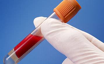 贫血需要补血吗,有地中海贫血孩子贫血怎么补血