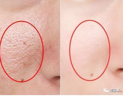 国货补水改善毛孔,国货之光美白缩毛孔