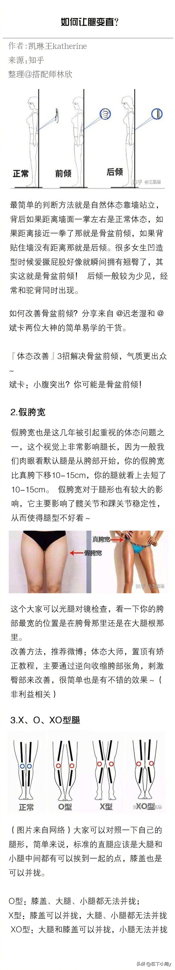 6岁小孩o型腿最快变直的方法,o型腿手术真的可以让腿变直吗