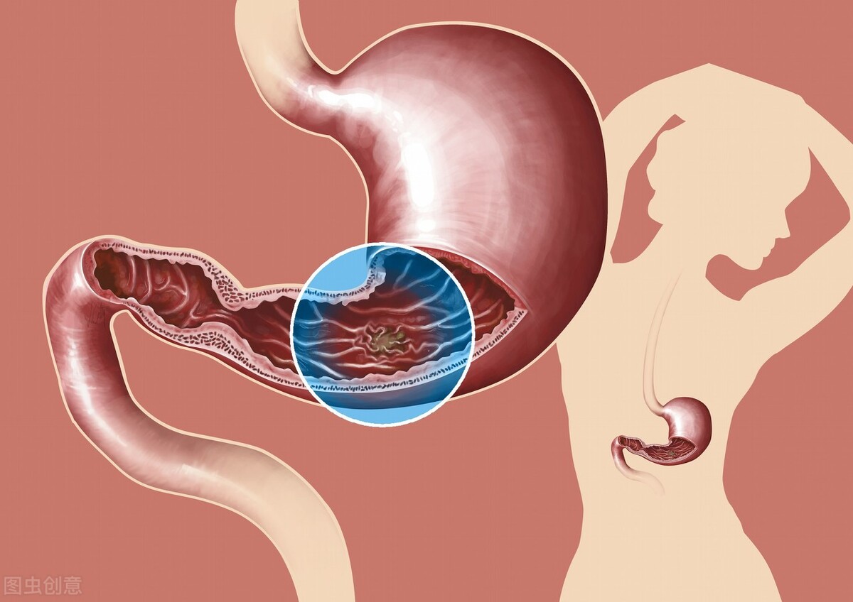 患上慢性萎缩性胃炎,得了慢性萎缩性胃炎怎么办