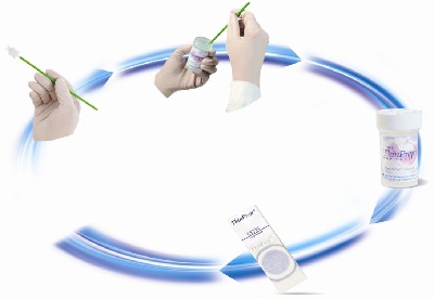 tct正常是不是基本可以排除宫颈癌,tct检查出宫颈管内的问题吗