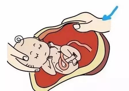 剖腹产宝宝要做什么训练,剖腹产该怎么训练