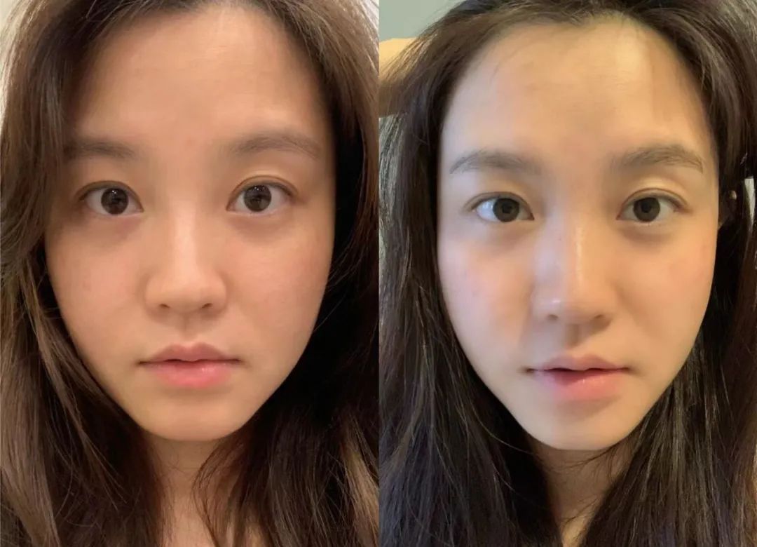 有没有免费做的医美项目,医美项目亲身经历