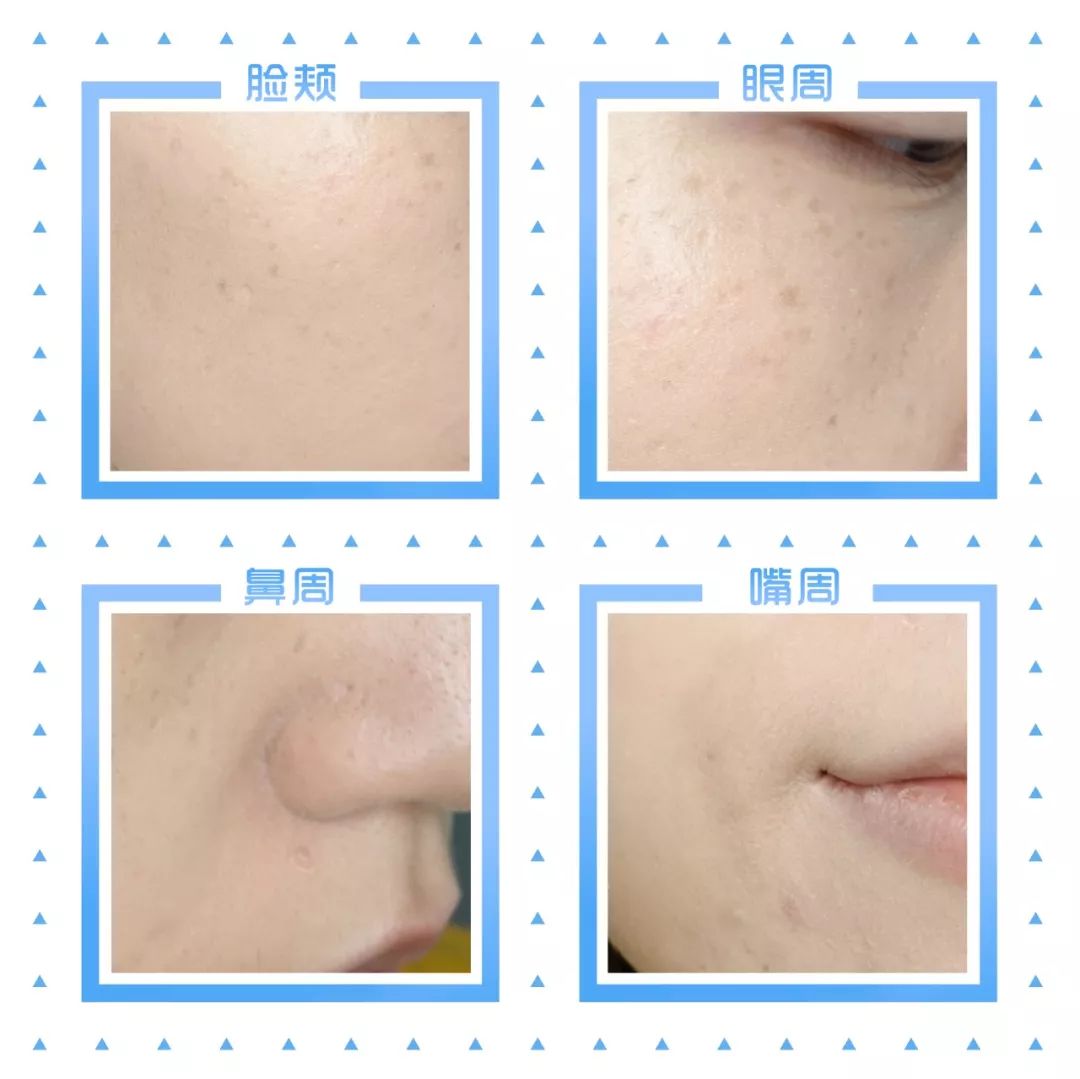 「Foundation101」遮瑕组在线battle!谁才是水煮蛋之王？（上）