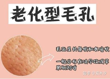 几种类型毛孔粗大改善的方法,毛孔粗大如何用科学方法改变