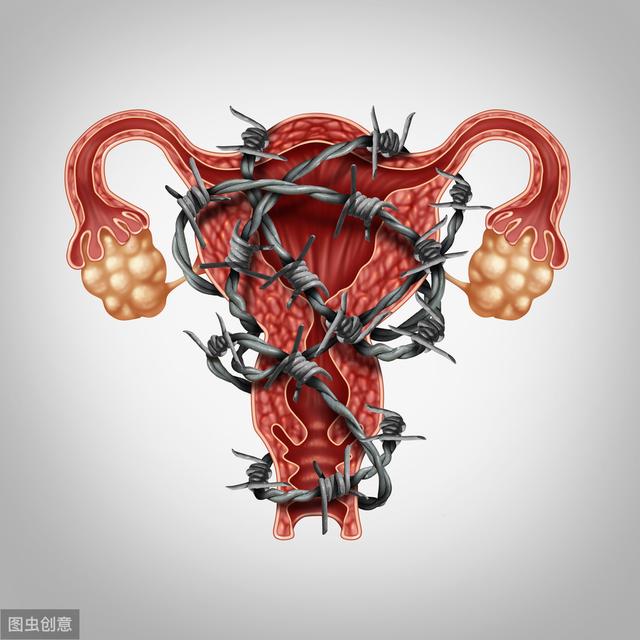 卵巢巧克力囊肿容易复发吗,卵巢巧克力囊肿容易恶化吗