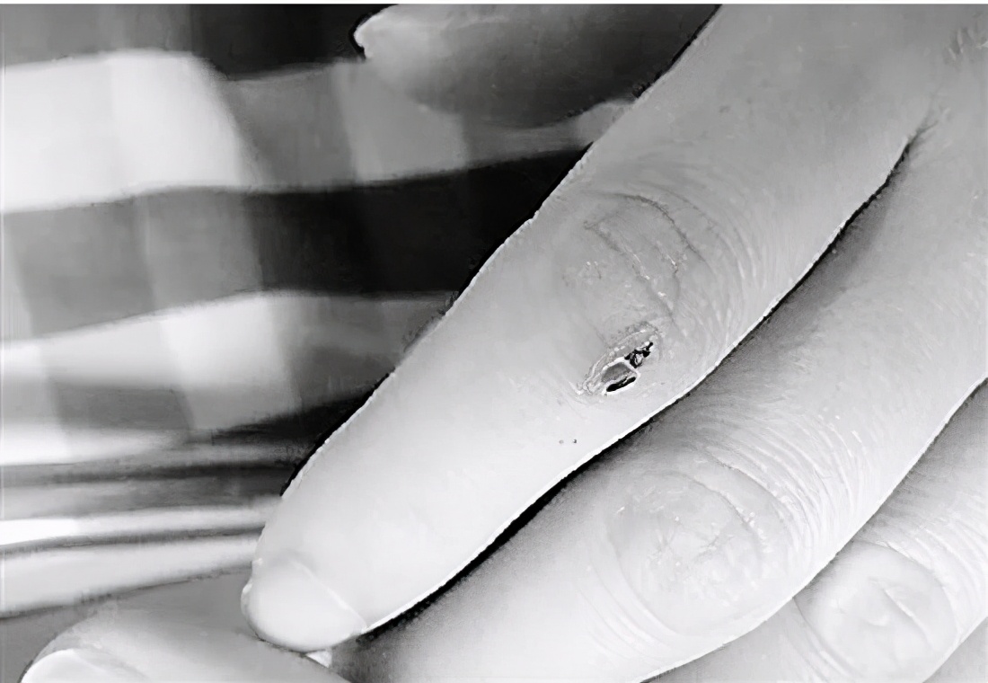 什么蛇最毒咬到了人会怎么样,毒性最强的蛇多久可以致死