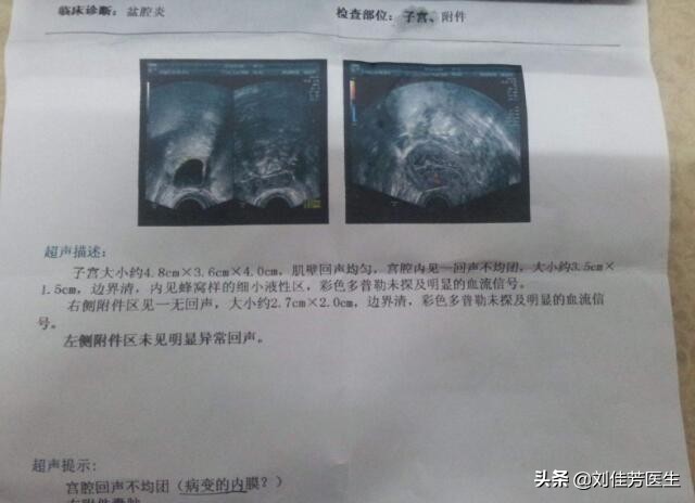 盆腔炎导致不孕的征兆,盆腔积液不孕有什么办法