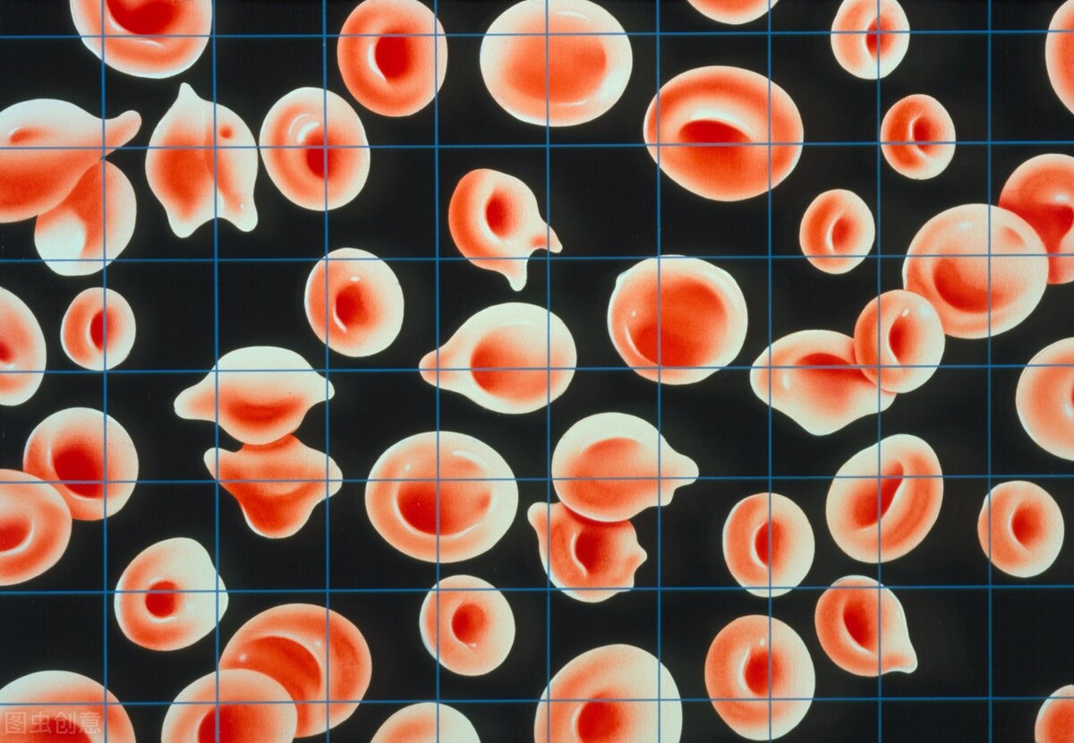 女性贫血十大补铁食物,贫血补铁吃什么维生素好