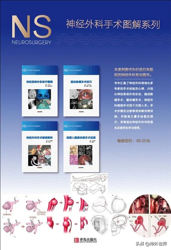 日本脑部筛查,日本脑神经功能检测仪