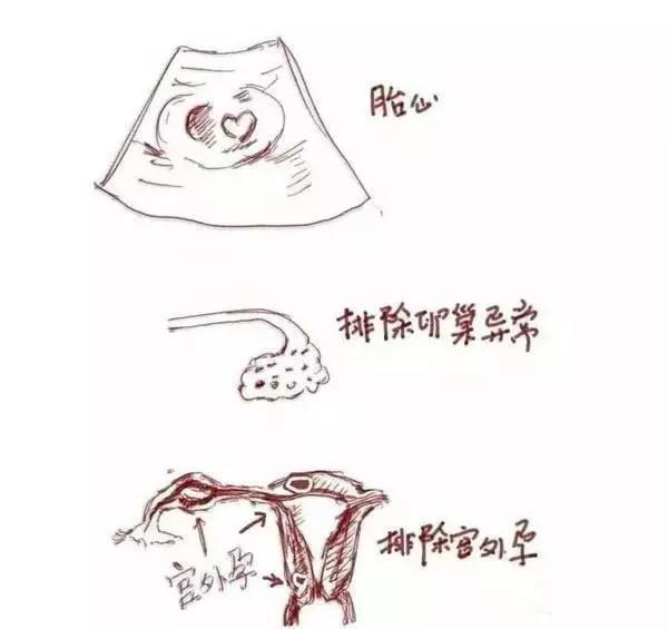 阴超真的干净卫生吗,b超和阴超区别太大