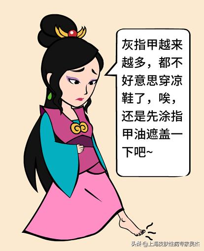 穿凉鞋有助于治疗灰指甲吗,穿凉鞋如何掩盖灰指甲