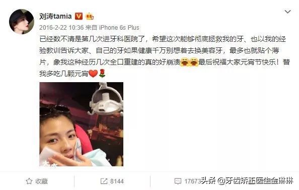 明星全口烤瓷牙的危害,明星为什么都做烤瓷牙