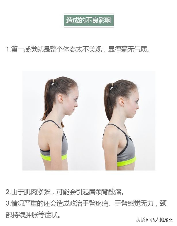 乌龟颈怎么矫正躺姿,乌龟颈最好的锻炼方法