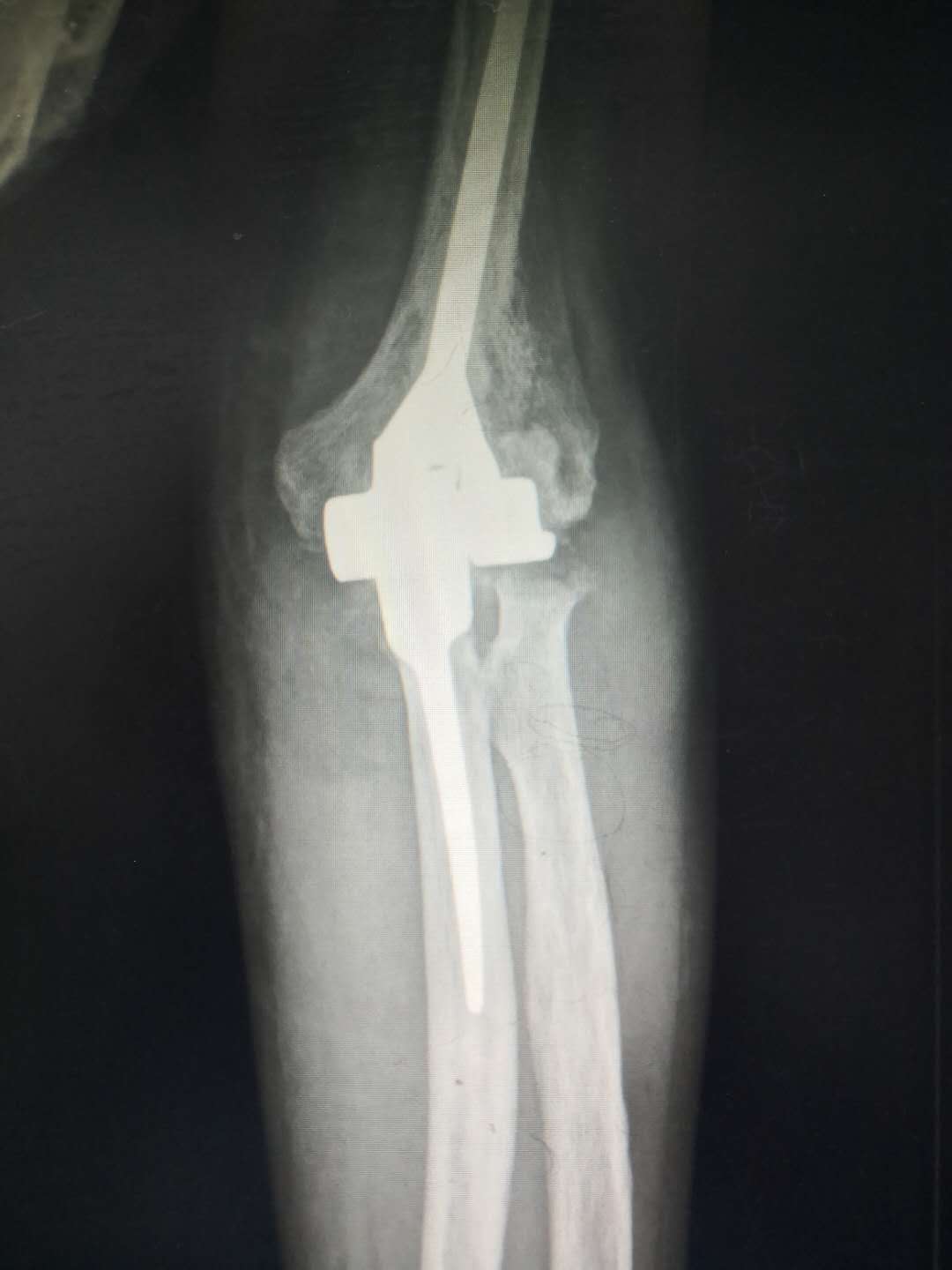 张忠根教授授课简介,李春根发改委