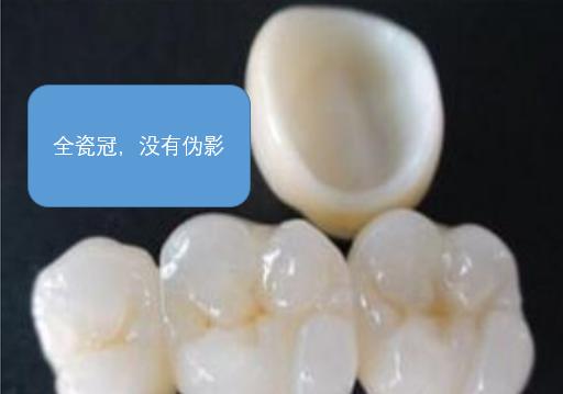 辟谣快速缓解牙疼,辟谣消炎药是抗生素