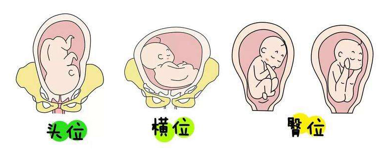 胎儿在几周容易胎停,胎儿胎位不正要怎么跟胎儿沟通呢