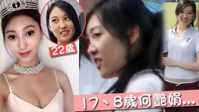 整容疑云孙艺珍,整容疑云郭晋安