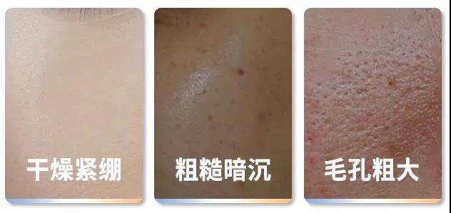 空调房皮肤干燥痒怎么快速解决,屋里干燥皮肤痒