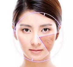 这令人烦心的酒糟鼻到底该如何应对？