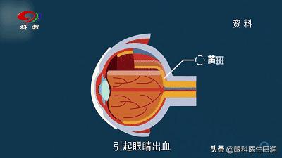 情人舞蹈挑战,情人舞蹈挑战视频