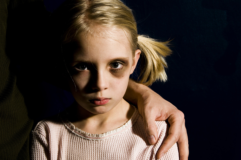 儿童有黑眼圈眼袋是肾虚还是脾虚,黑眼圈是脾虚还是肾虚肝虚