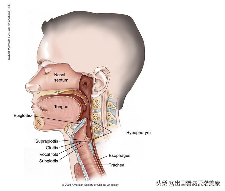 肿瘤专家下咽癌,美国癌症协会最新肺癌数据